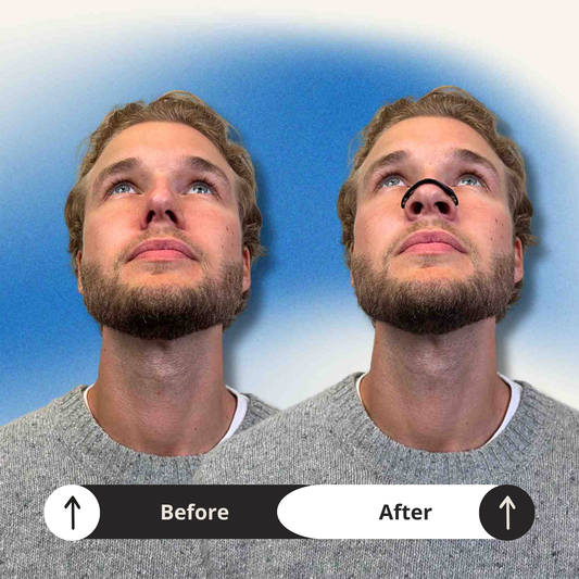 Magnetic nasal strip